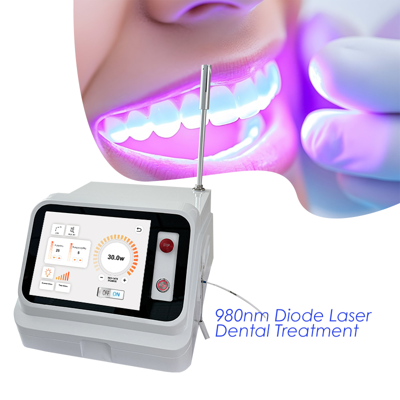 2024 Hot Sale Dental Soft Tiss - Teeth Whitening With Laser ulasan dan harga