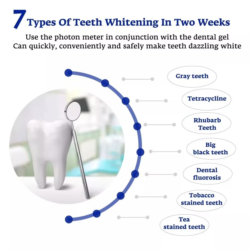 Intelligent LED Blue Light Por - Teeth Whitening With Blue Light ulasan dan harga
