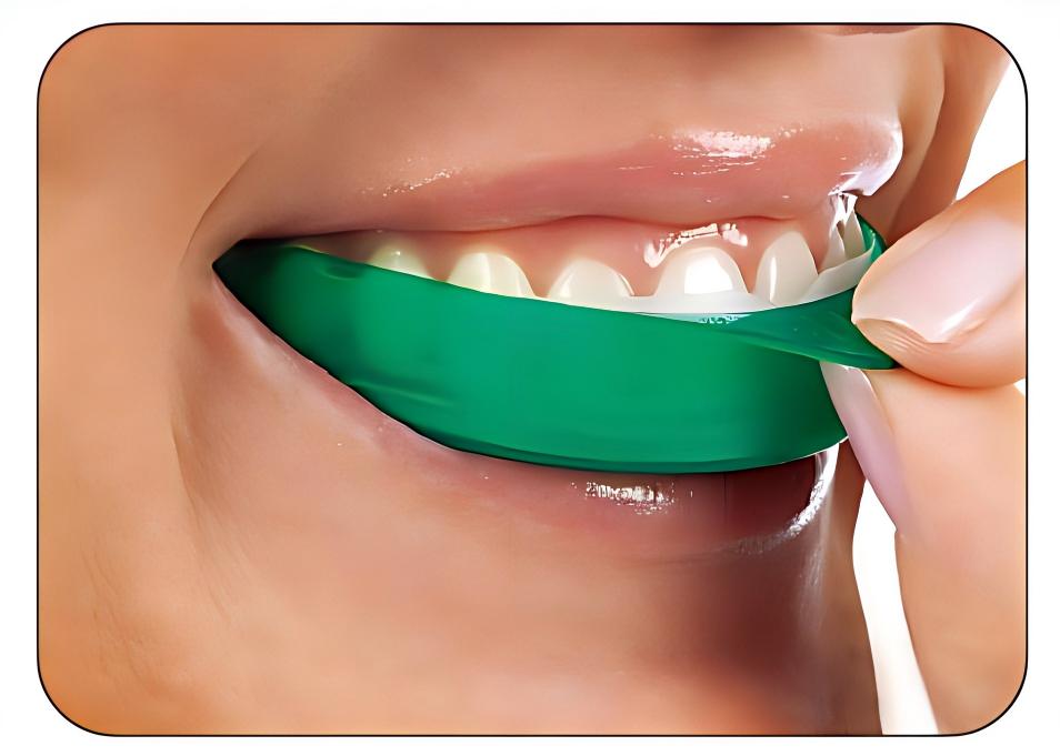 Ultradent Opalescence Go Teeth - Teeth Whitening Opalescence Go ulasan dan harga