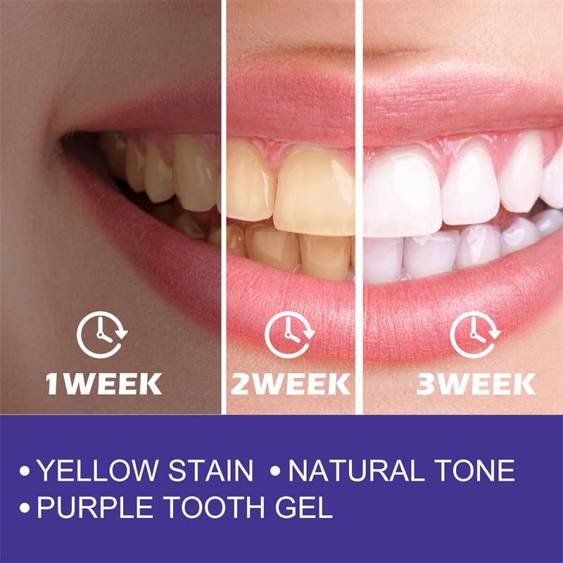 1pcs Teeth Cleansing Whitening - Teeth Whitening In Korea ulasan dan harga