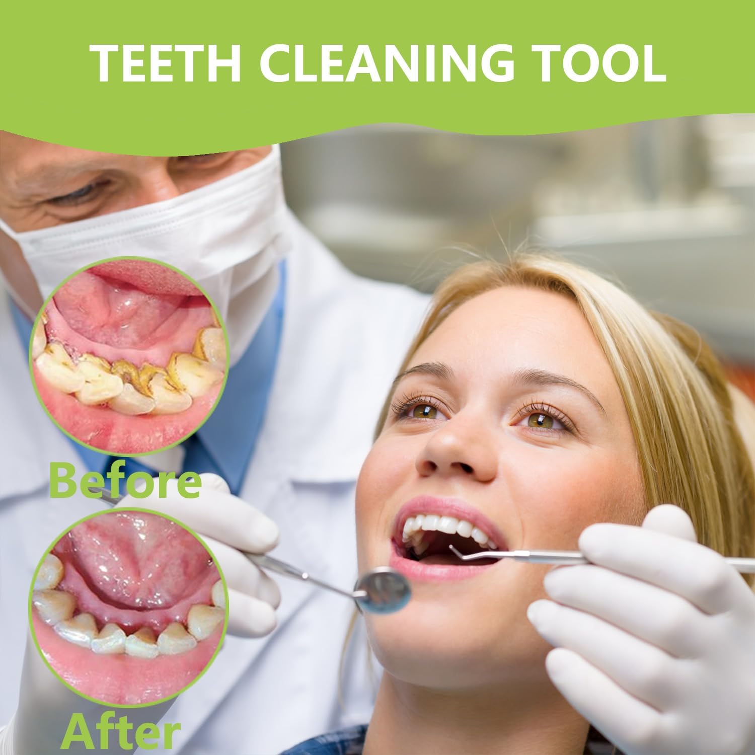 Professional Teeth Cleaning Or - Teeth Whitening Mouthwash ulasan dan harga