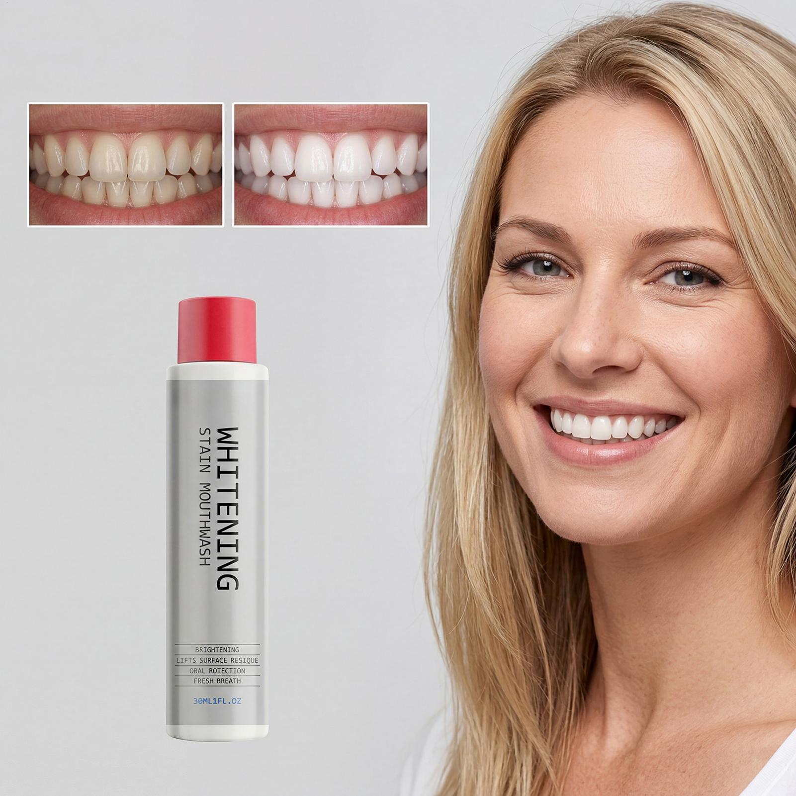 30ml Stain Whitening Mouthwash - Teeth Whitening Mouthwash ulasan dan harga