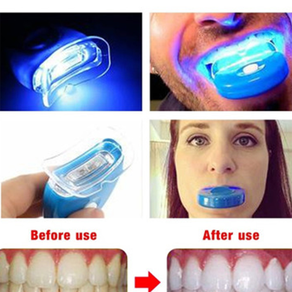 New Blue Led Teeth Whitening A - Teeth Whitening With Laser ulasan dan harga