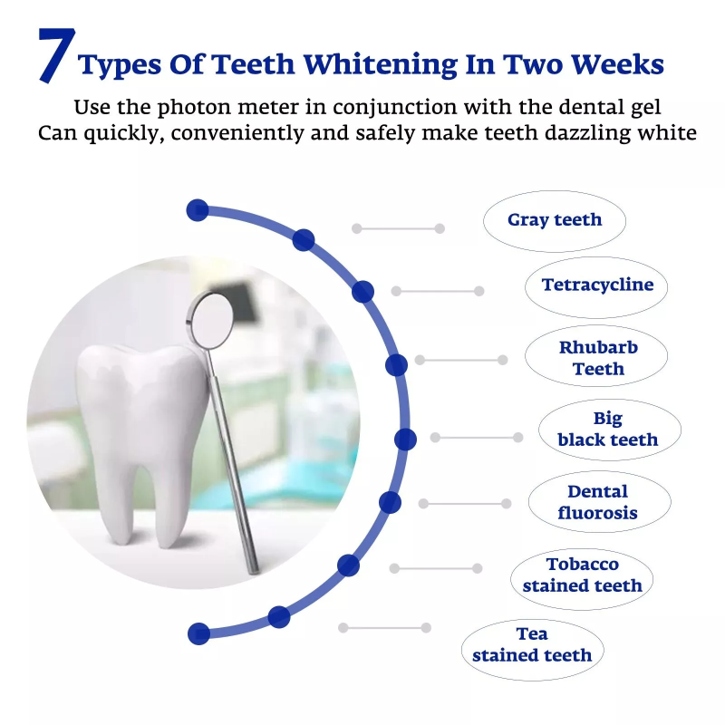 Teeth Whitening Accelerator Sm - Teeth Whitening With Blue Light ulasan dan harga