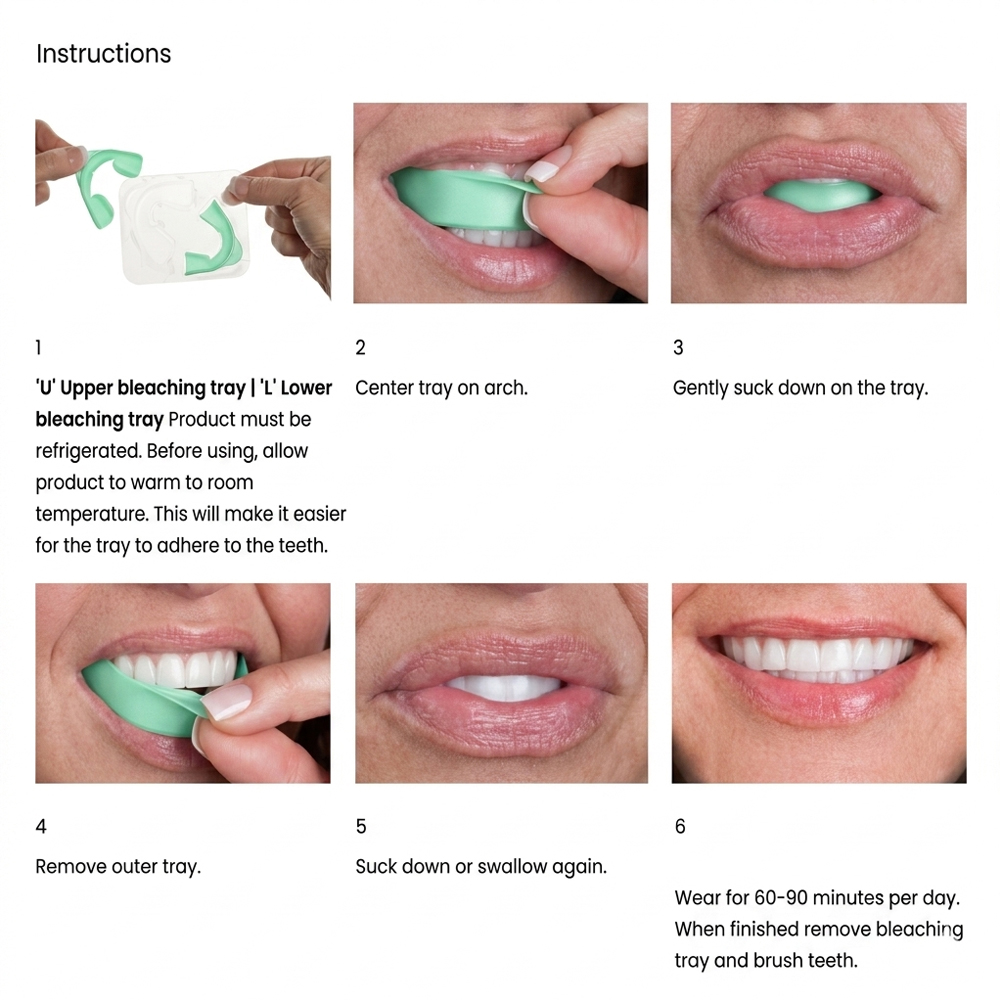 Opalescence GO 6% Hydrogen Per - Teeth Whitening Opalescence Go ulasan dan harga